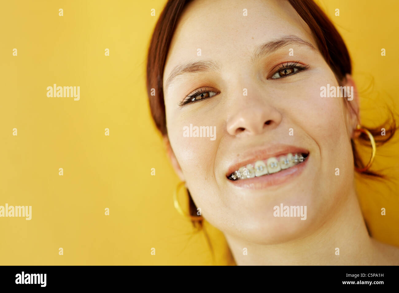 College braces compilation Telegraph
