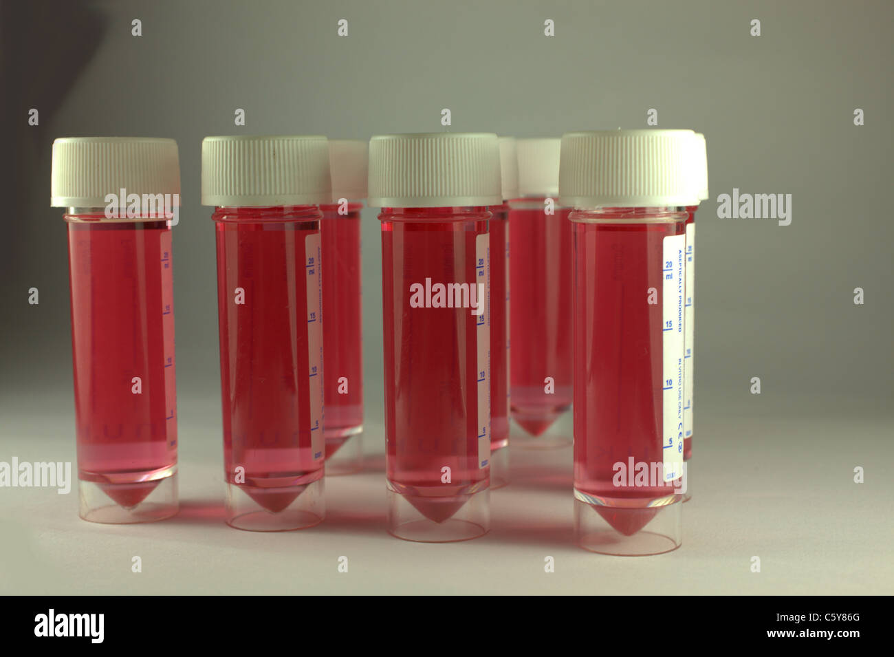 bodily fluids awaiting testing and analysis Stock Photo Alamy