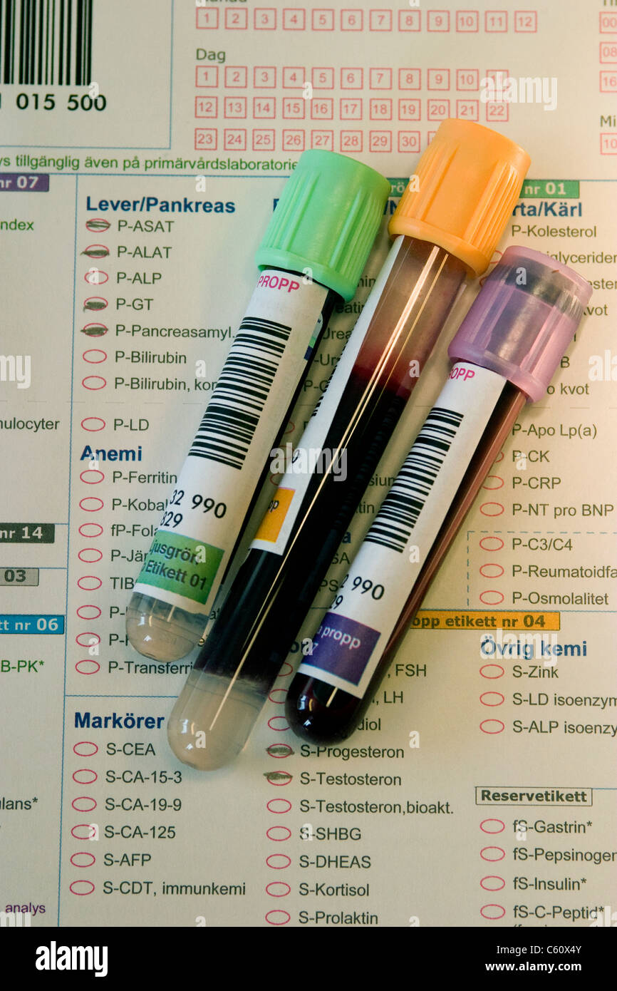 Blood samples in test tubes in front of the test order (In Swedish) Stock Photo