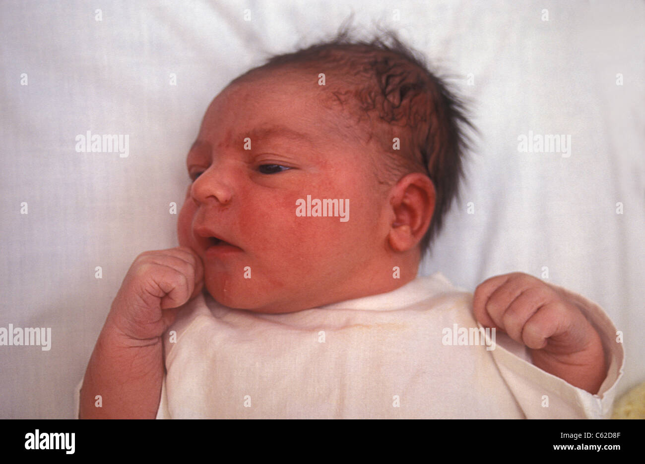 newborn baby with elongated head due to long labour Stock Photo