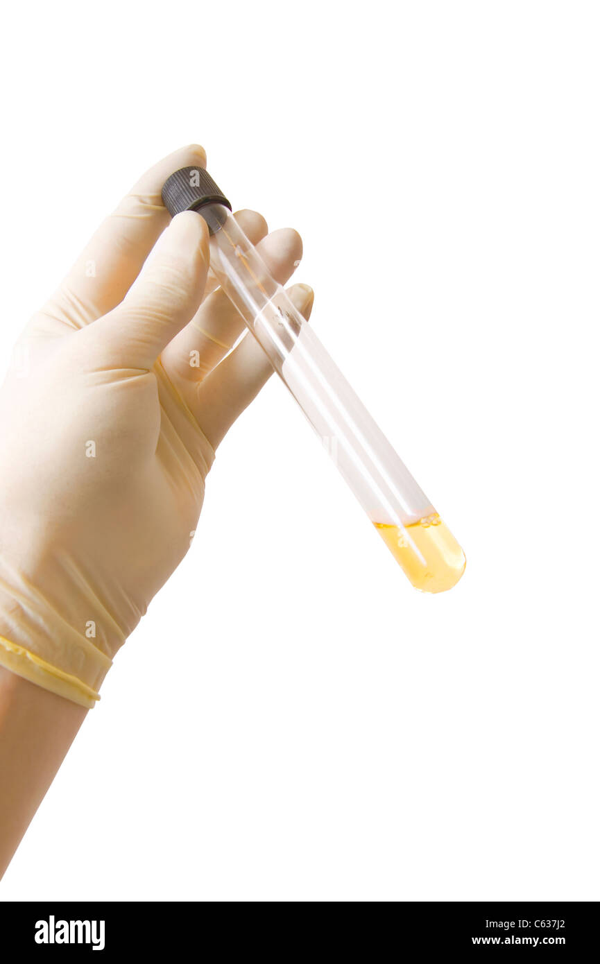 Hand in gloves holding research tube with golden liquid, on white background Stock Photo