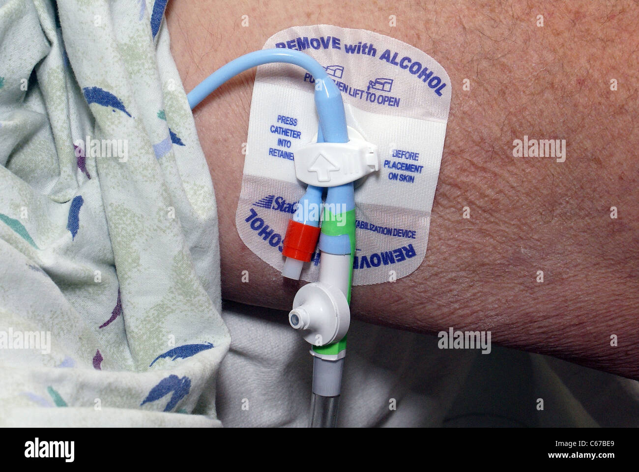 Catheter to drain bladder is attached to leg Stock Photo Alamy