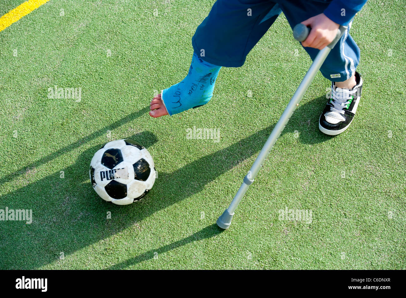 Boy with broken Leg in Cast with crutches Stock Photo Alamy