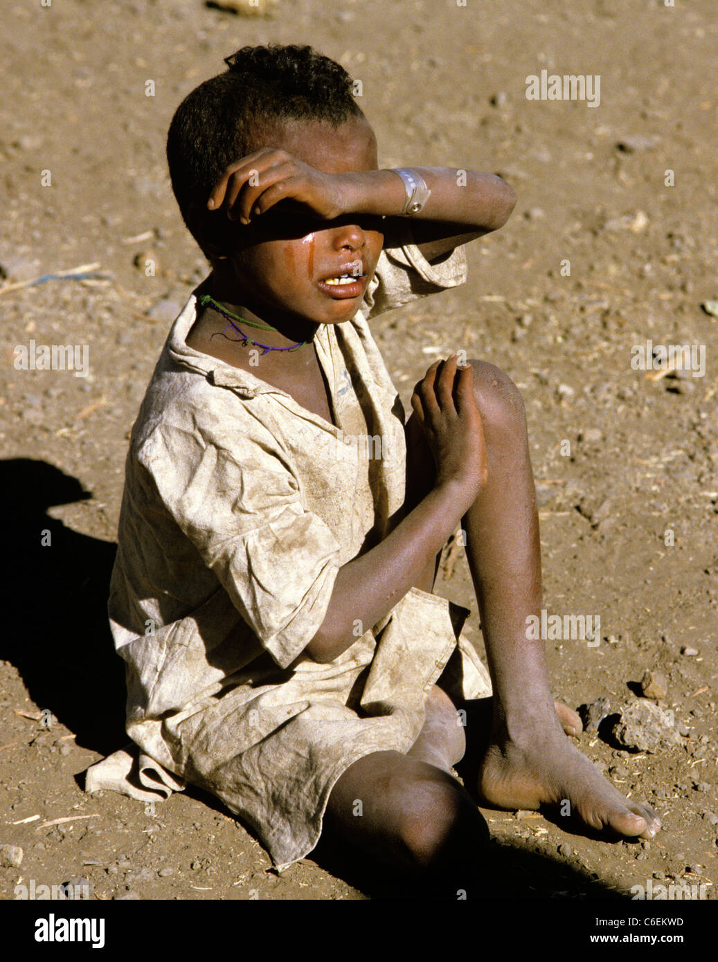 weeping child at famine relief camp near Lalibela in Northern Ethiopia Stock Photo