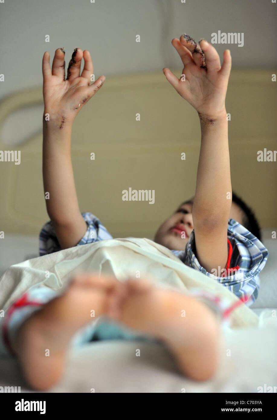 seven fingers eight toes there s not a glove in the world that ll