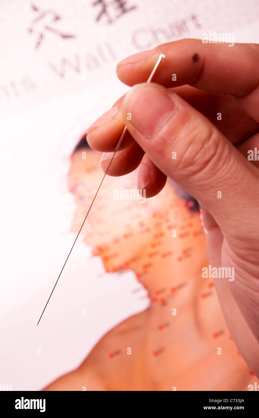 Hand acupuncture hi-res stock photography and images - Alamy