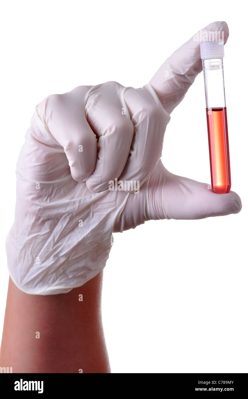 Hand holding a blood sample for analysis, isolated. Stock Photo