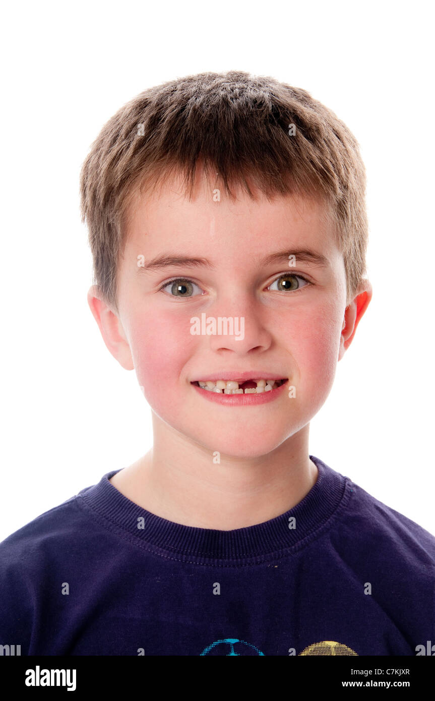 Young Boy With Missing Front Tooth Stock Photo