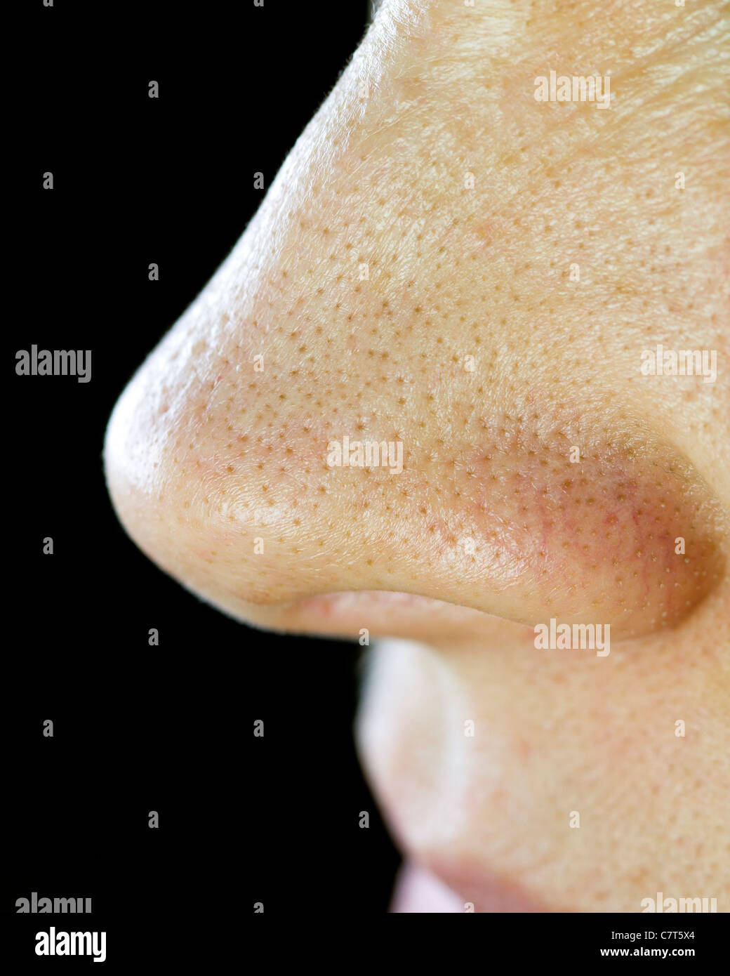 Nose with blackheads. Macro lens. Stock Photo