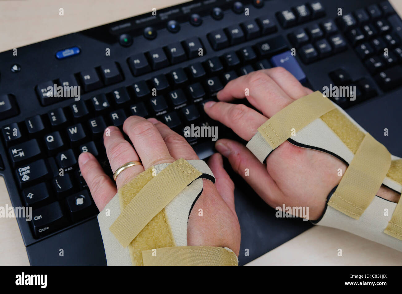 Man with Carpal Tunnel Syndrome and wearing wrist splints using a