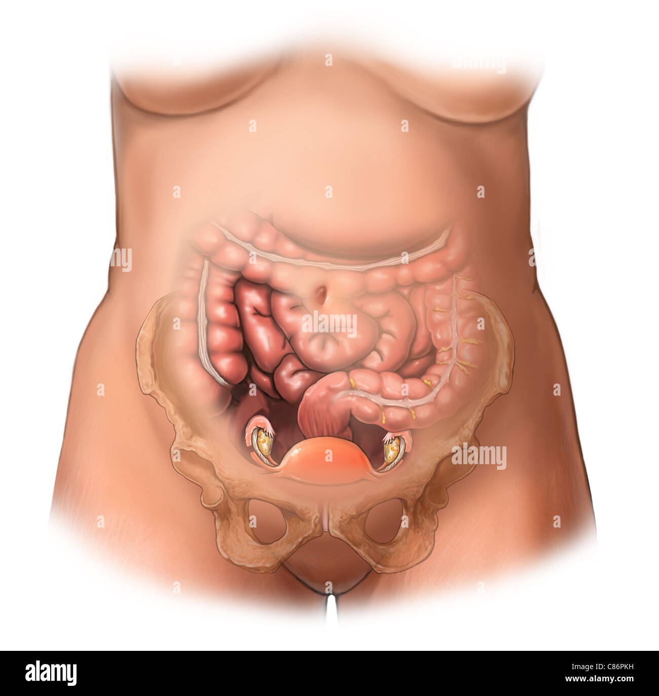 Bowel perforation hi-res stock photography and images - Alamy