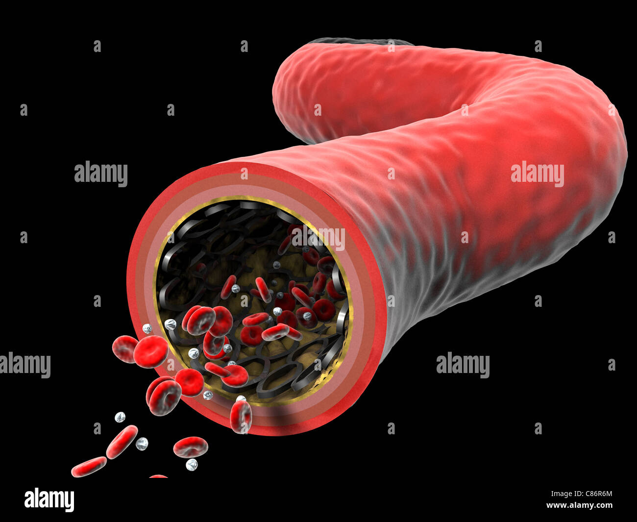 Plaque build up hires stock photography and images Alamy