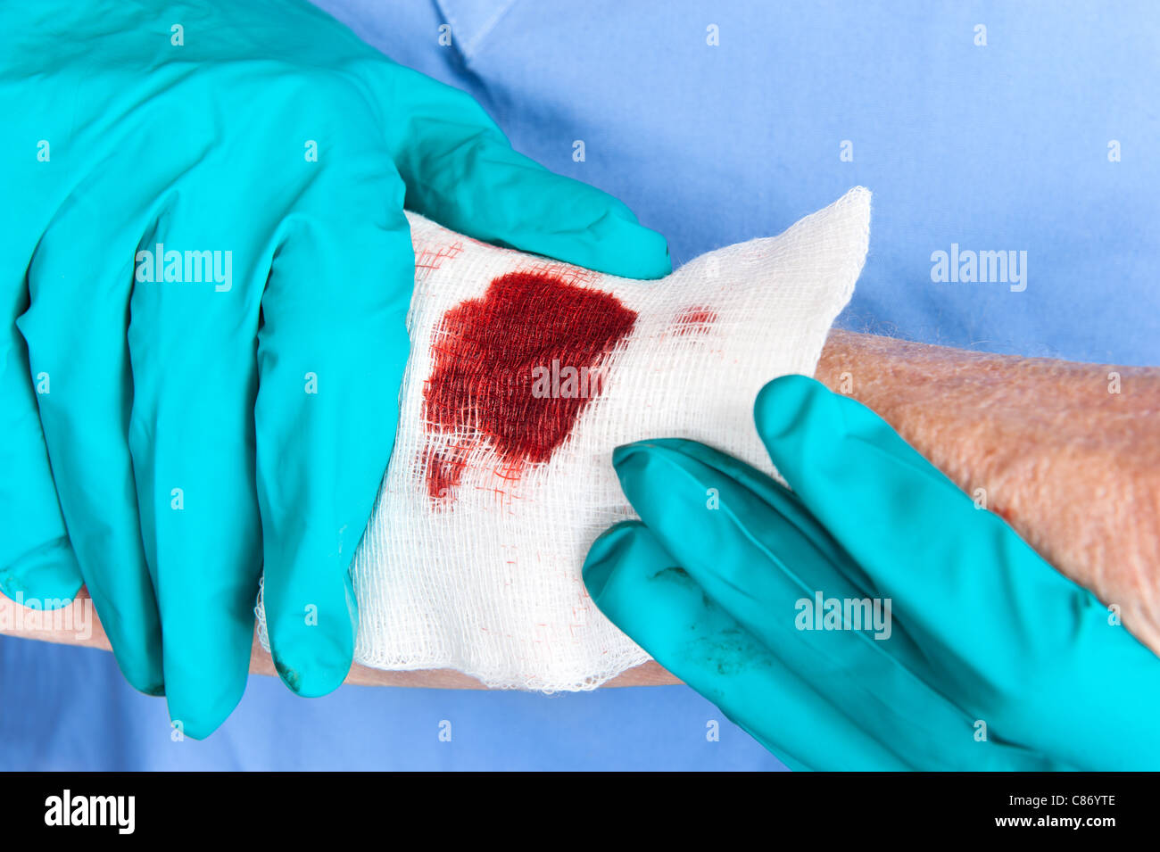 A nurse tends to a bloody wound on an elderly woman's arm Stock Photo