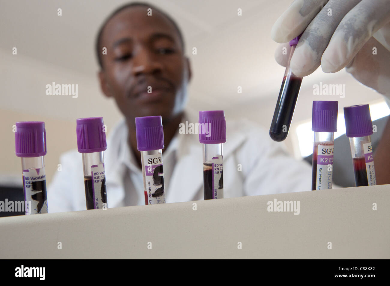 A Laboratory technicians test blood samples of HIV patients at a hospital in Luanshya, Zambia. Stock Photo