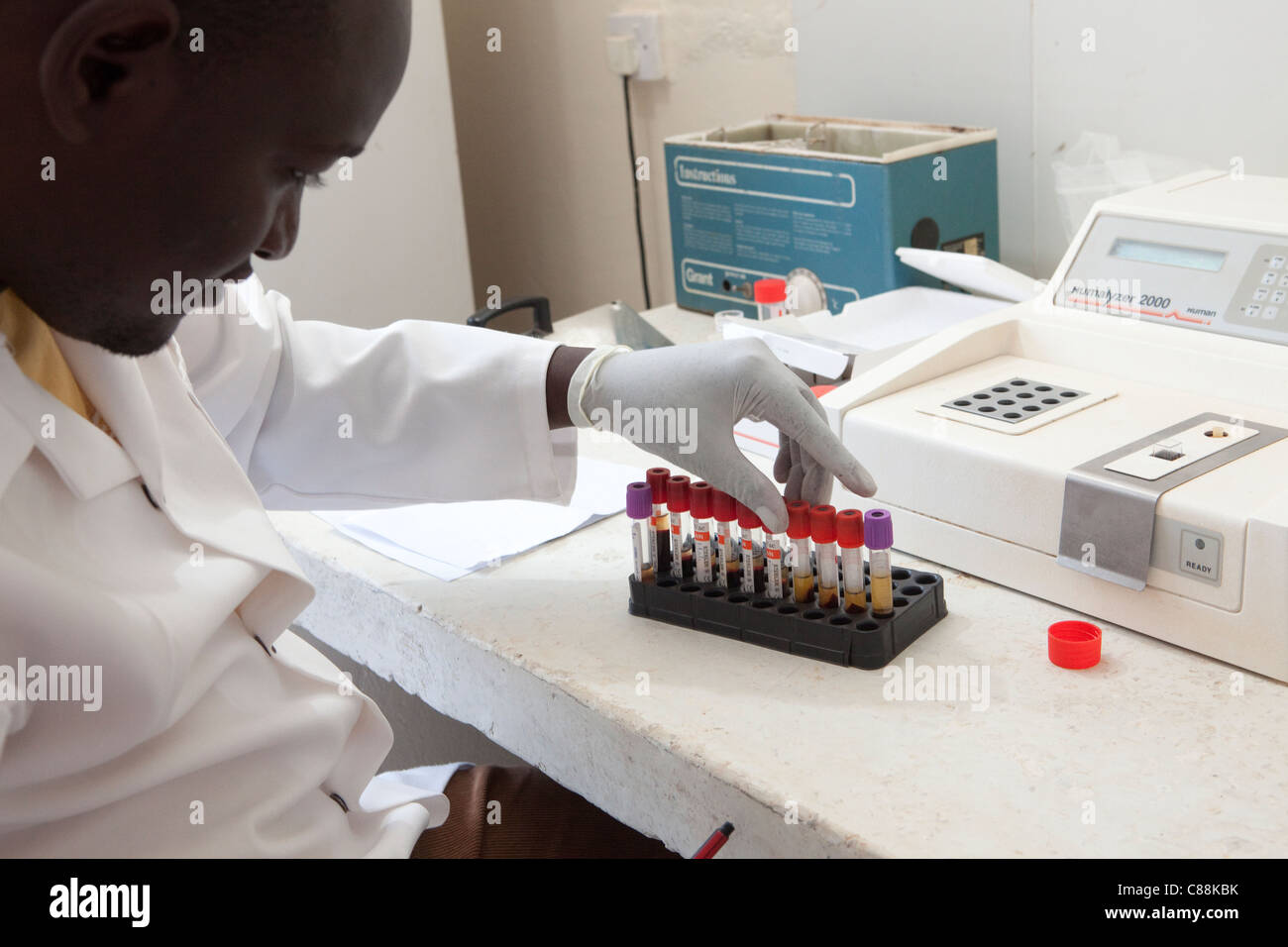 A Laboratory technicians test blood samples of HIV patients at a