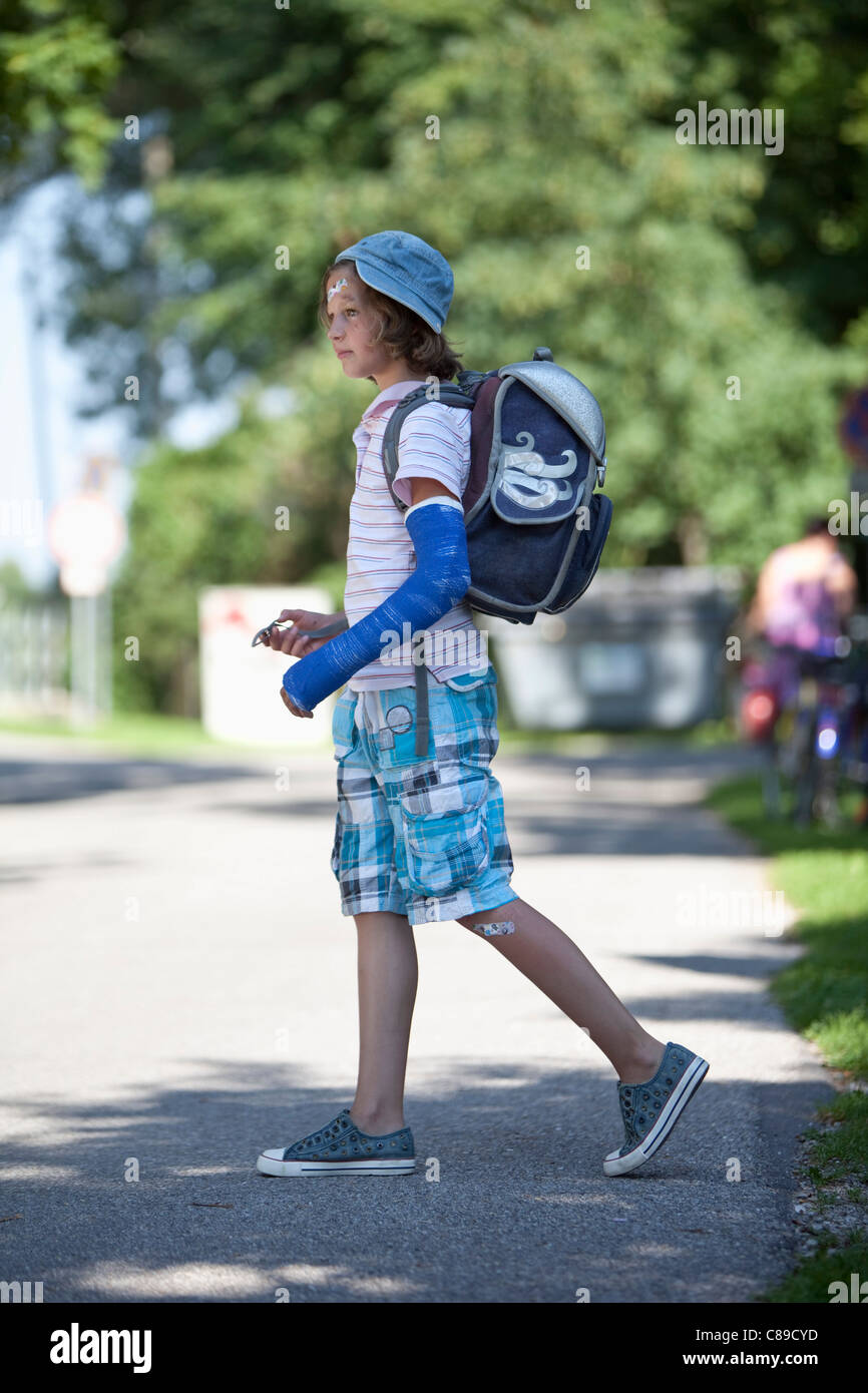 Arm cast hires stock photography and images Alamy