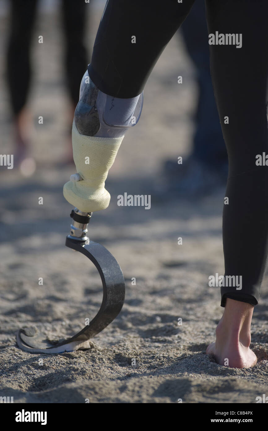 Person with prosthetic leg Stock Photo