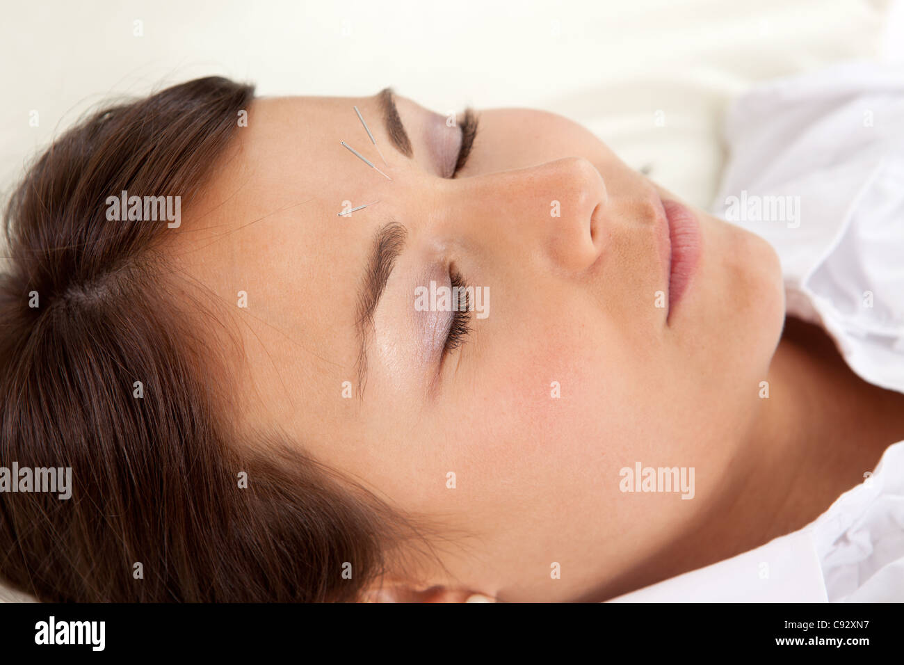Acupuncture needles face hires stock photography and images Alamy