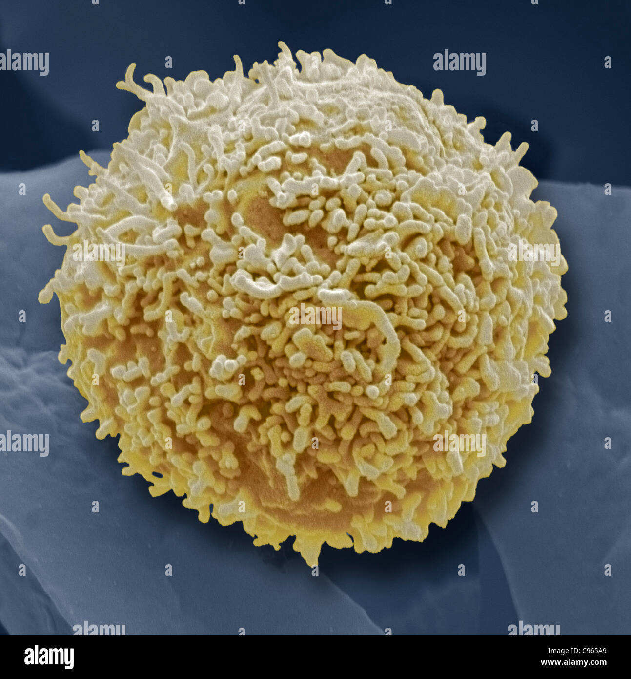 Lymphocyte white blood cell, SEM Stock Photo Alamy
