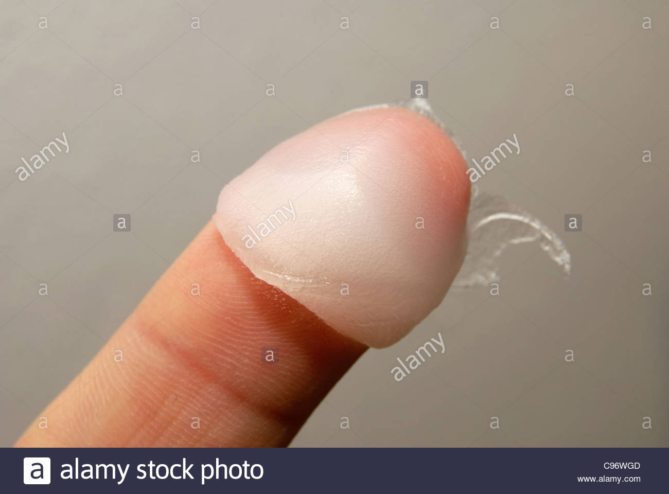Petroleum jelly on the end of a male index finger. - Stock Image