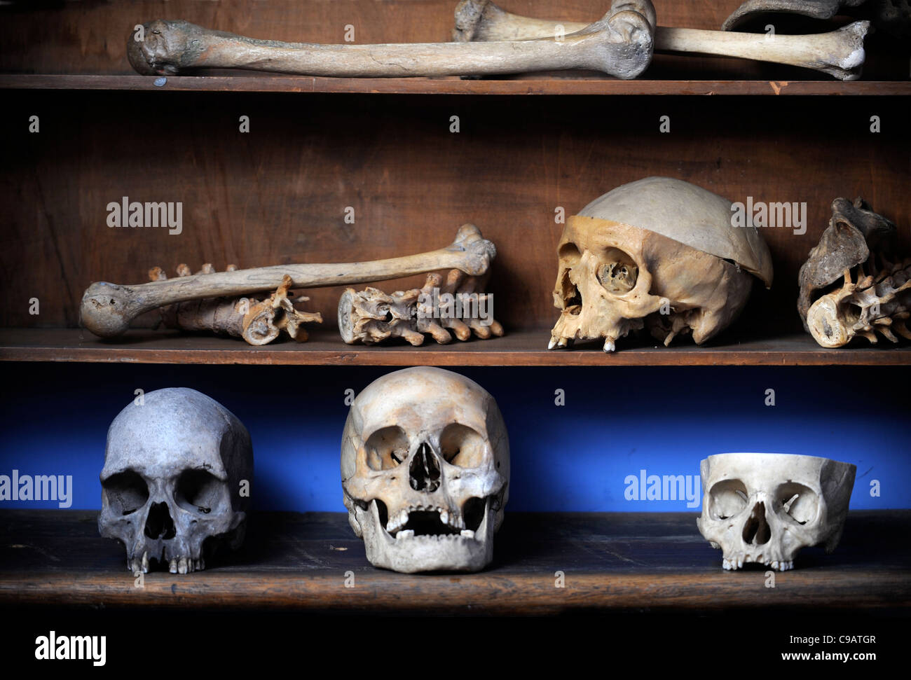 The Shambles Victorian Village in Newent, Gloucestershire - a museum of Victoriana - Skulls and bones in the doctor's surgery Stock Photo