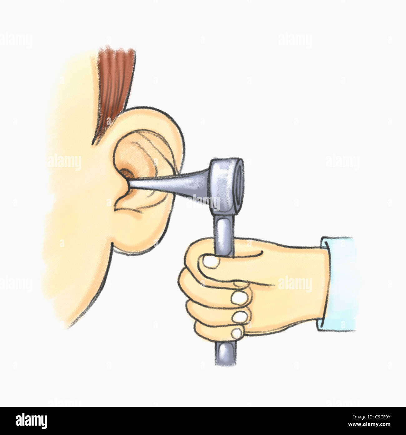 Капли для уха от боли. Пробки в ушах перекись водорода. Что закапать в ухо при шуме. Что закапать в ухо при шуме. Что закапать в ухо при шуме.