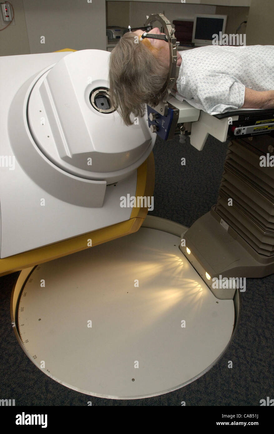 The Radiosurgery Center at John Muir Medical Center where brain tumor patient Patricia Larson