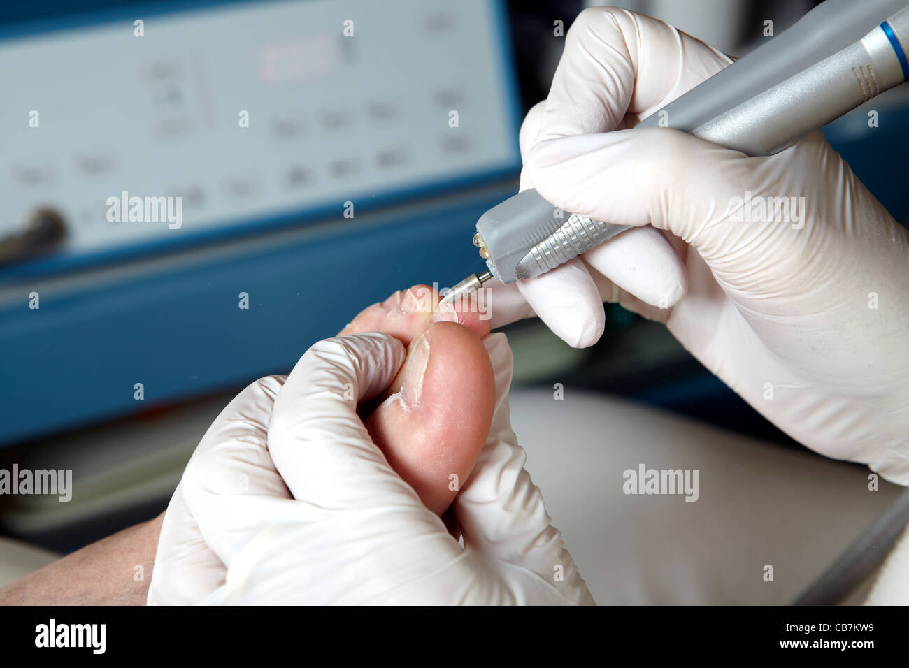 A podiatrist edit the toenails with a grinding machine Stock Photo