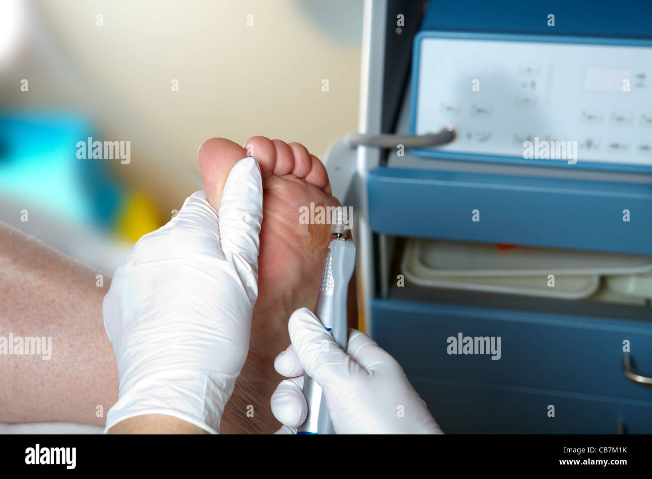 A podiatrist edit the toenails with a grinding machine Stock Photo