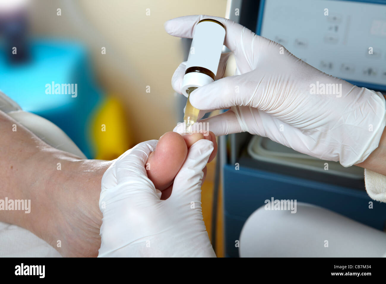 A podiatrist edited the toenails with Manicures oil Stock Photo