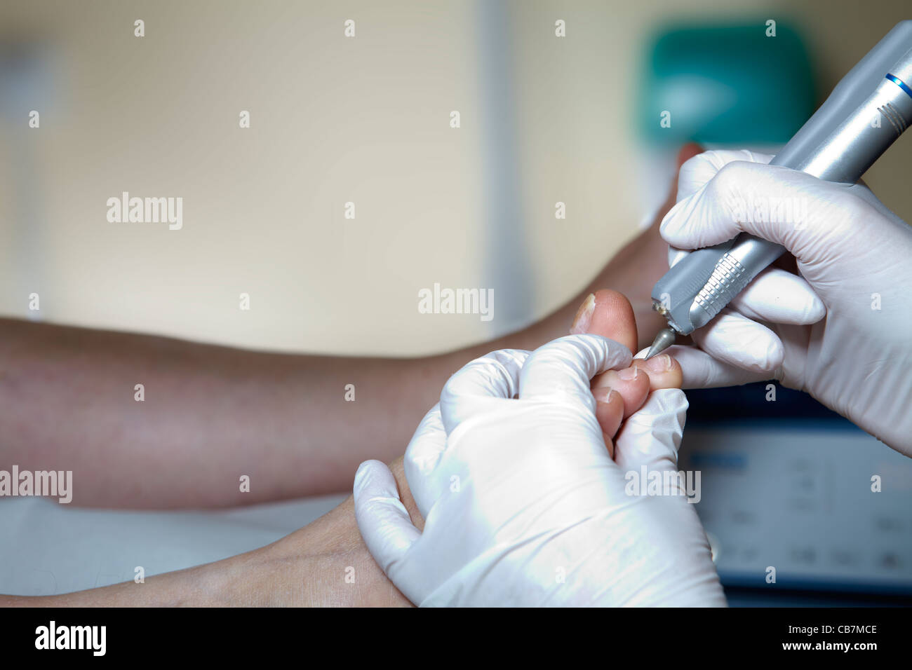 A podiatrist edit the toenails with a grinding machine Stock Photo Alamy