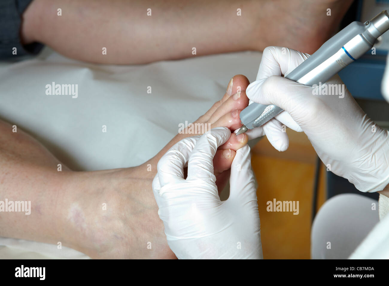 A podiatrist edit the toenails with a grinding machine Stock Photo Alamy
