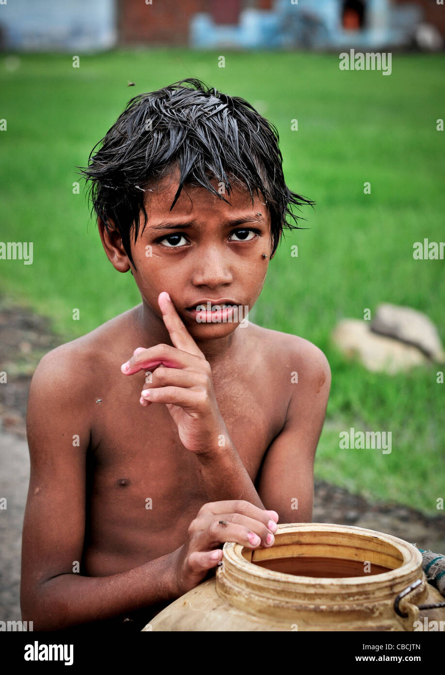 Poverty & malnutrition in India Stock Photo