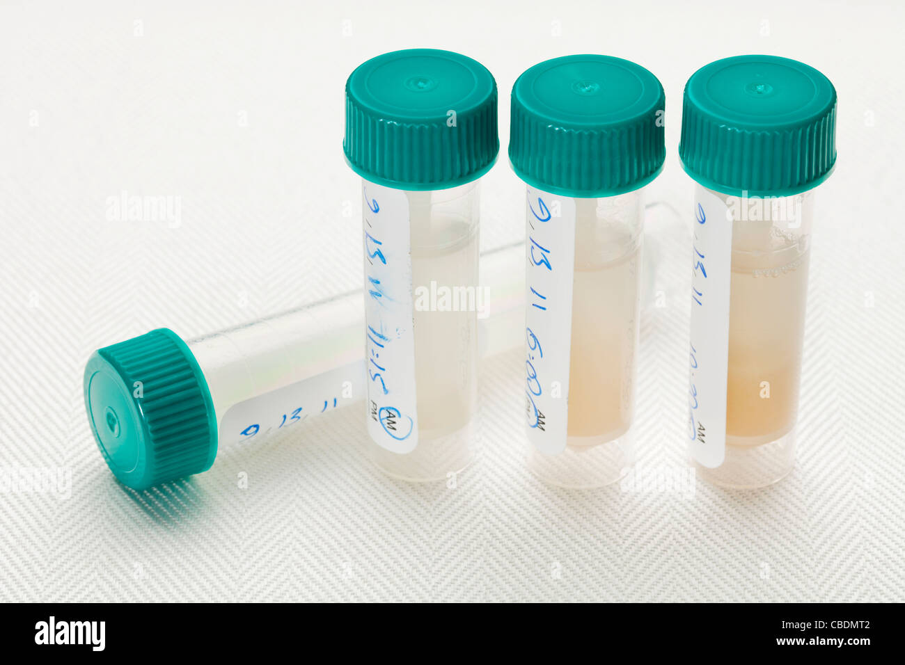 samples of saliva in plastic tubes collected at different time of day for laboratory hormone profile analysis Stock Photo