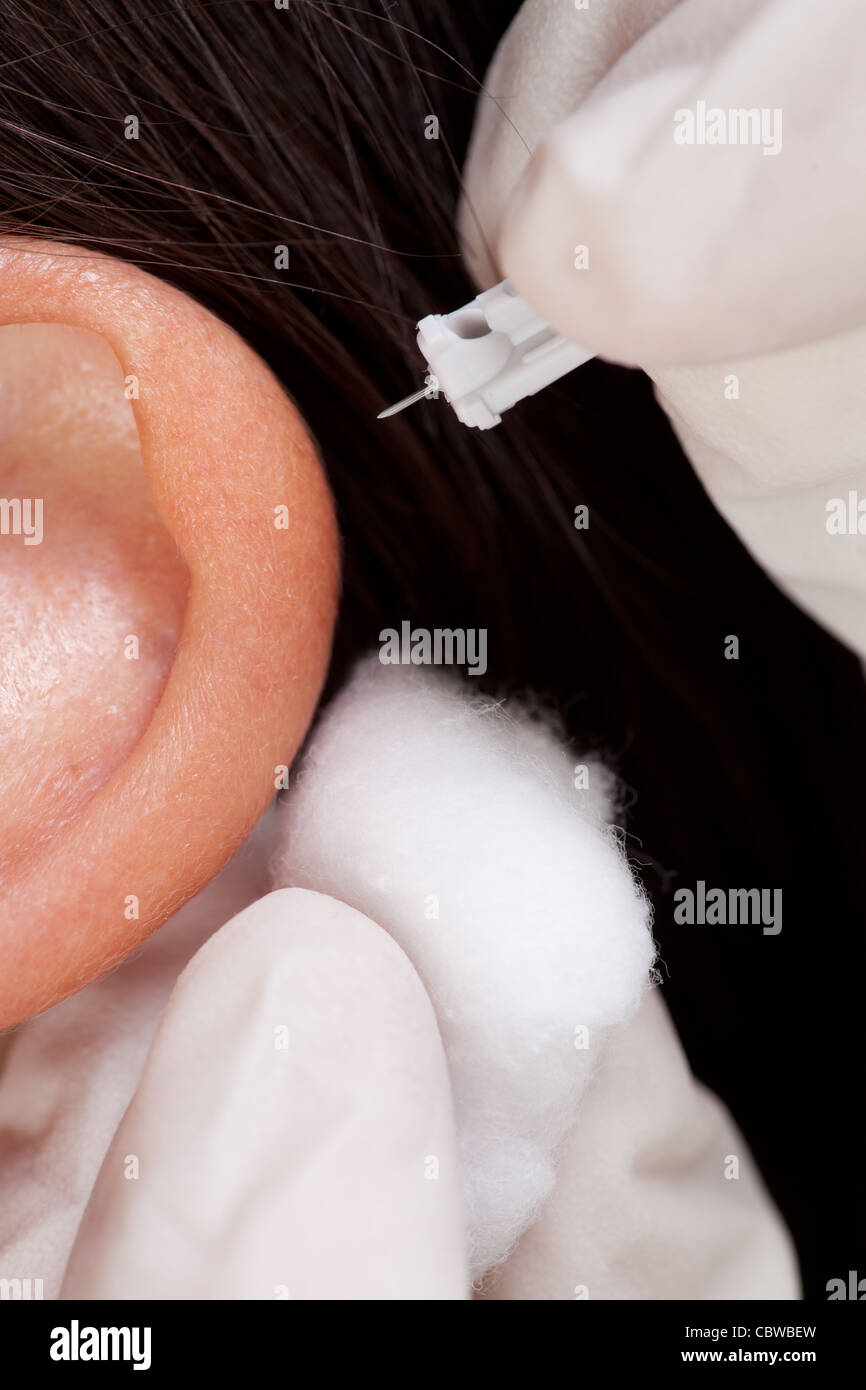 Bleeding ear hires stock photography and images Alamy