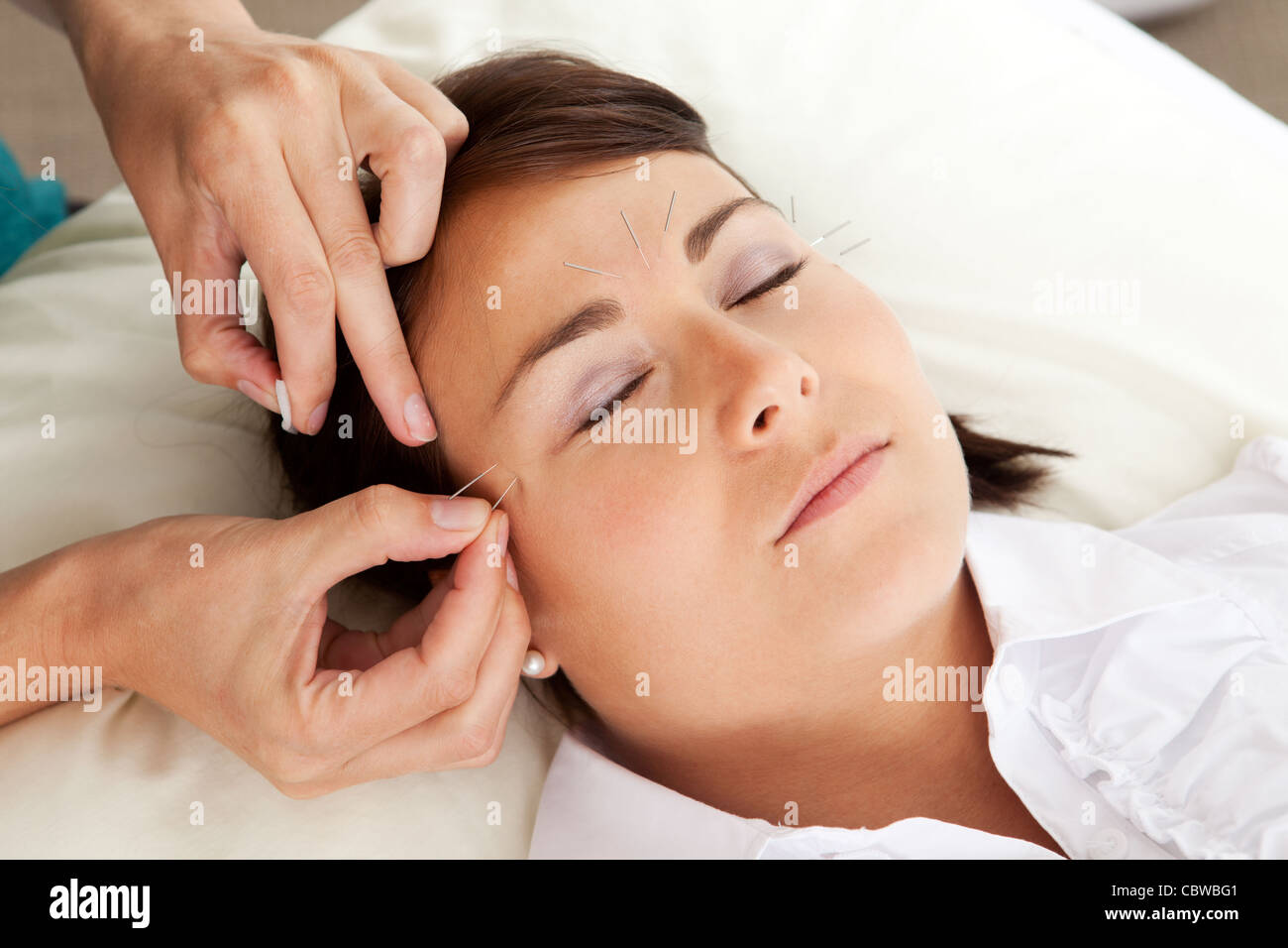 Vietnamese facial acupuncture Hot clip Vietnamese facial acupuncture