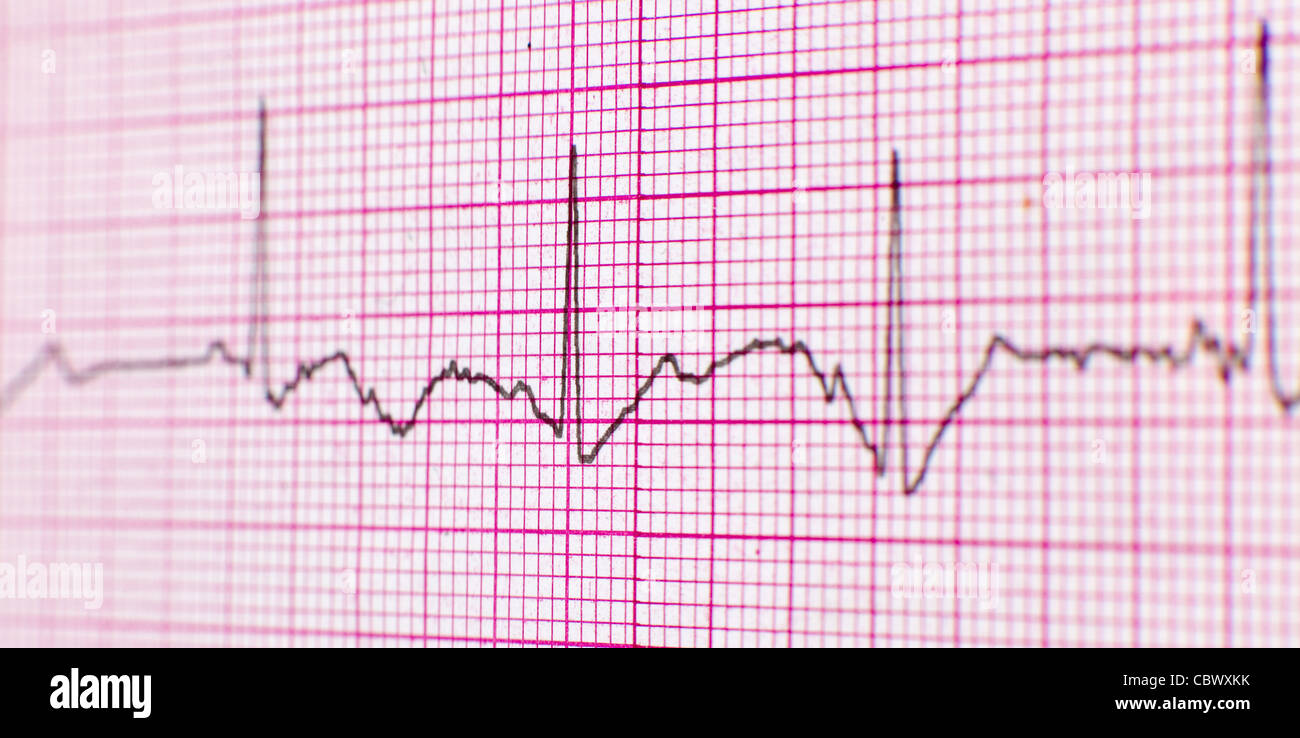 ECG printout Stock Photo