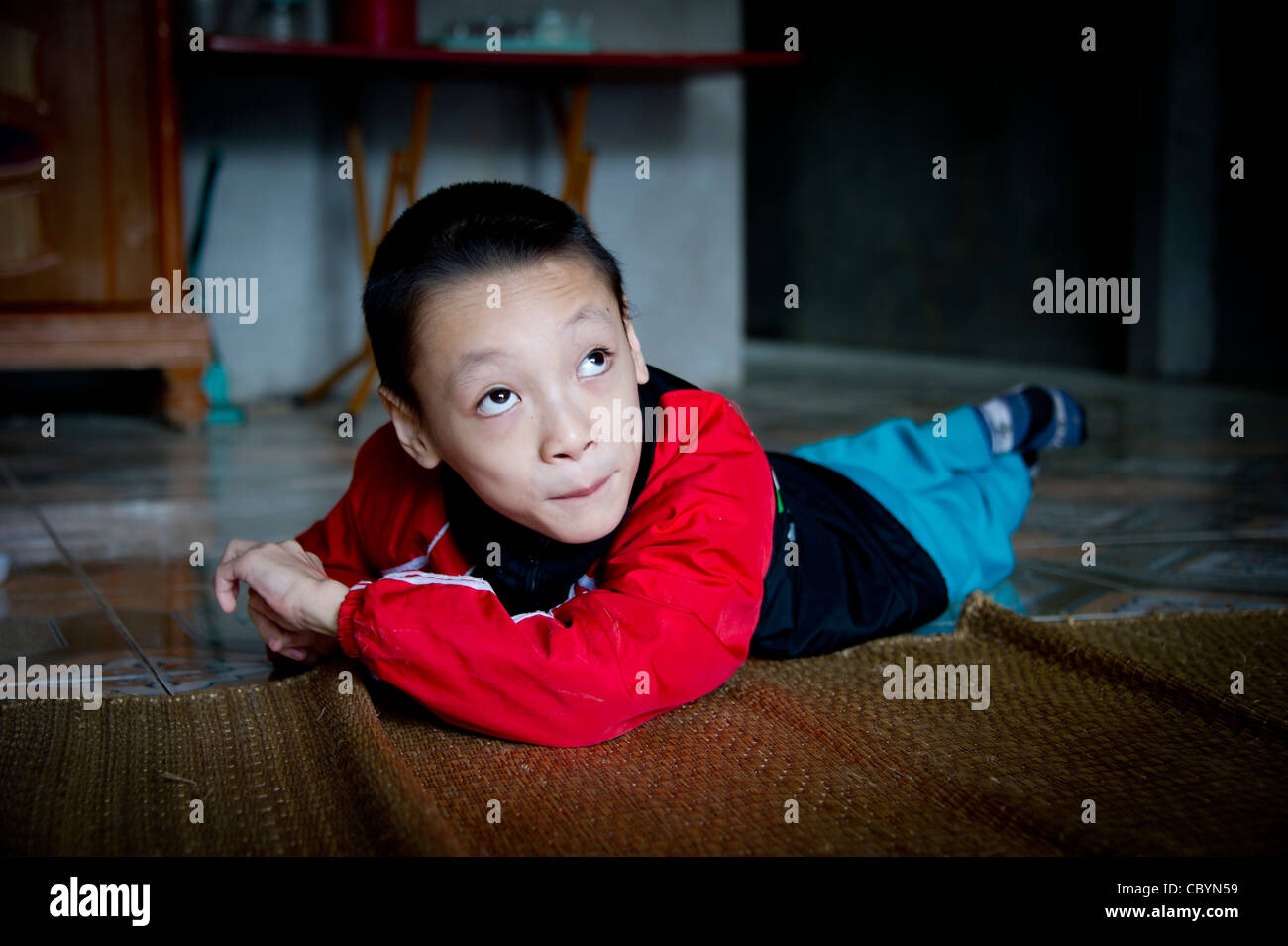 young cp Young Vietnamese boy diagnosed as Cerebral Palsy (CP) patient, the result  of a loss of oxygen immediately before / during birth Stock Photo - Alamy