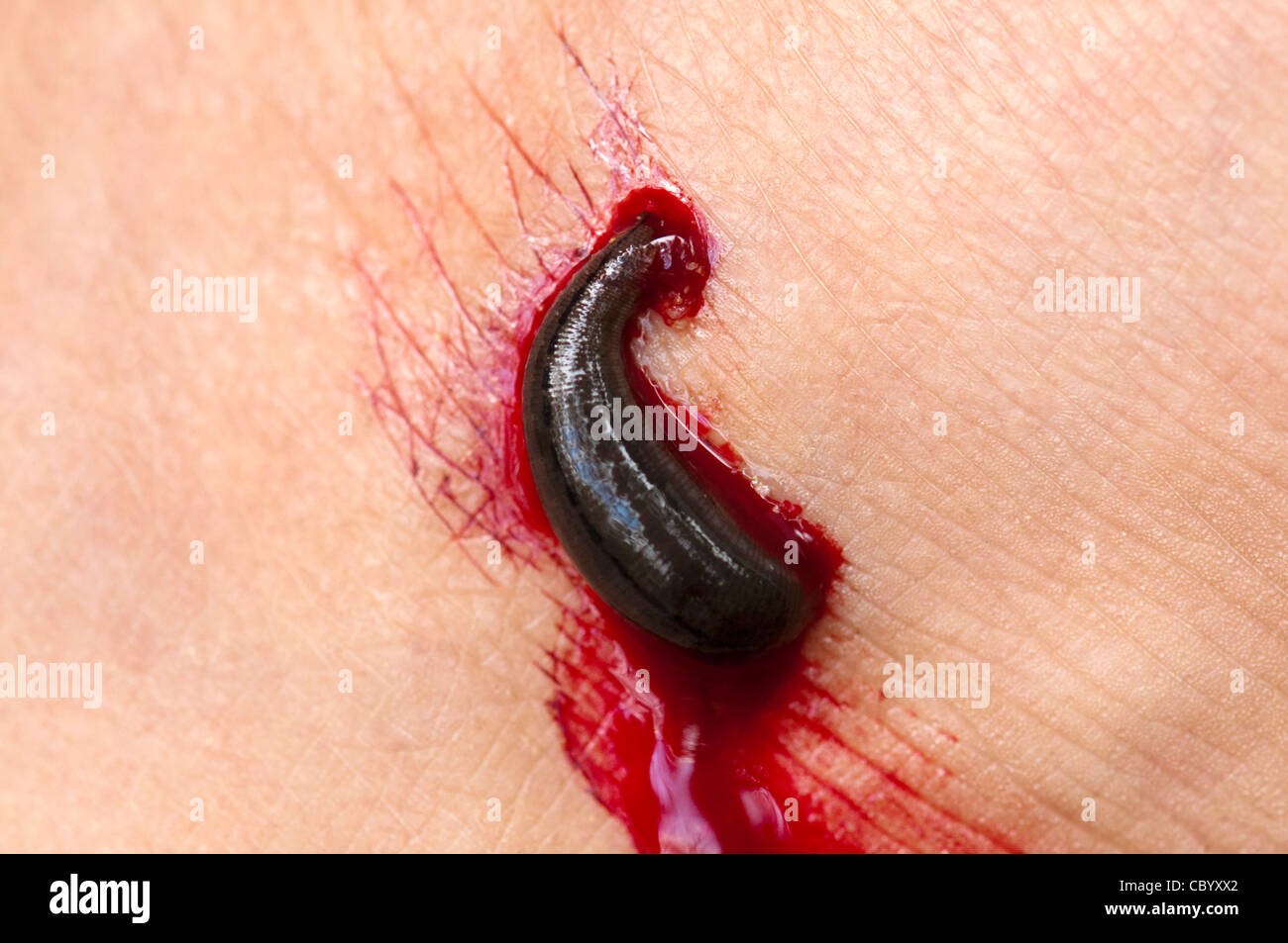 Leech parasite hi-res stock photography and images - Page 2 - Alamy