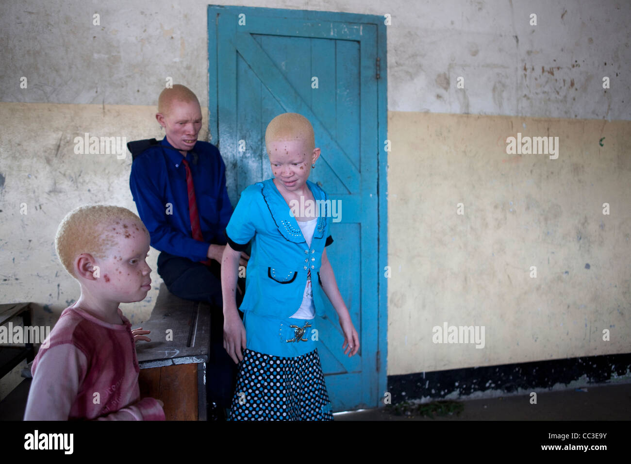 Albinos in Tanzania Stock Photo