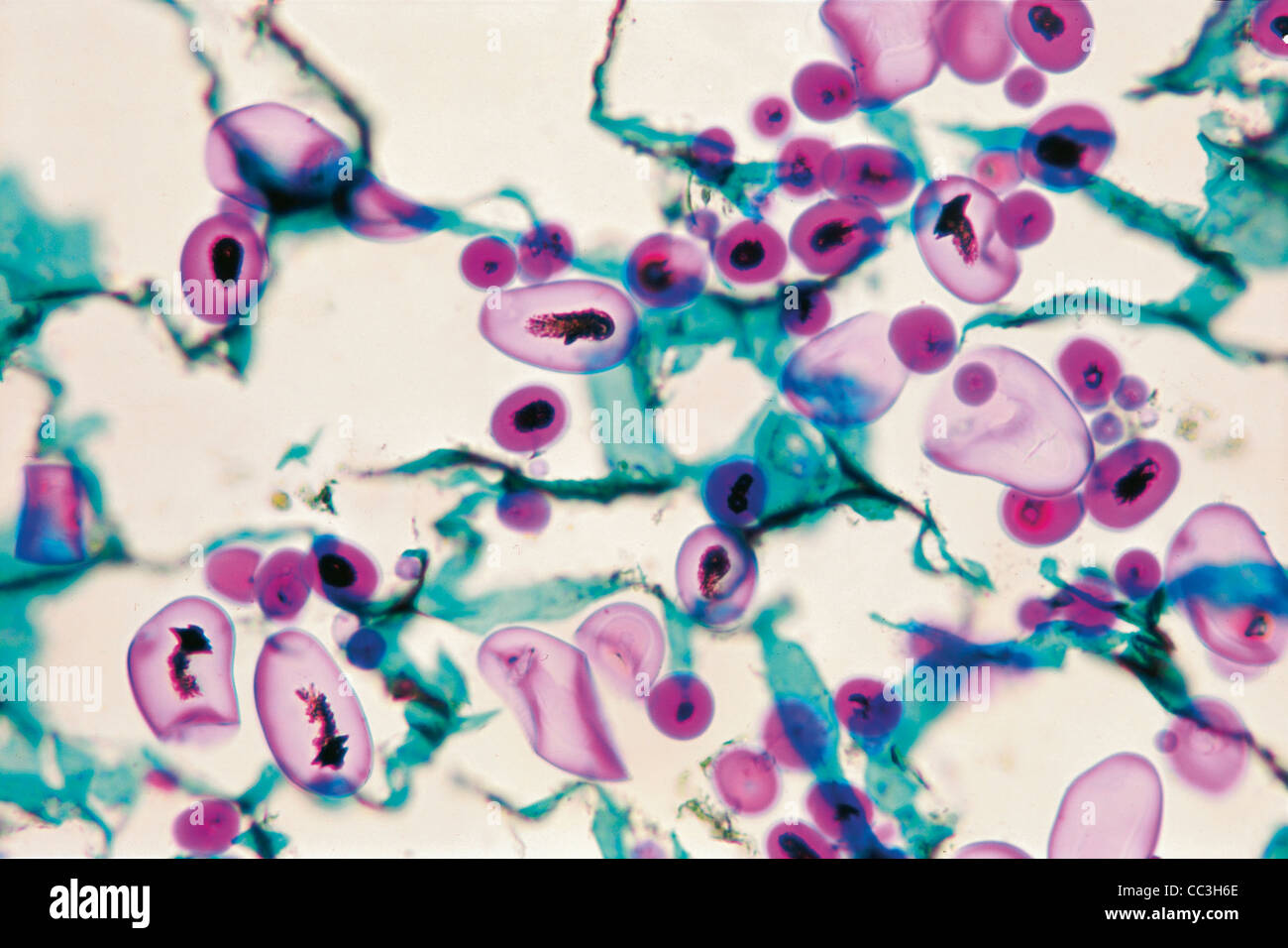 Botany. Starch Grains From Potato Tuber. Microscope Photo Stock Photo -  Alamy