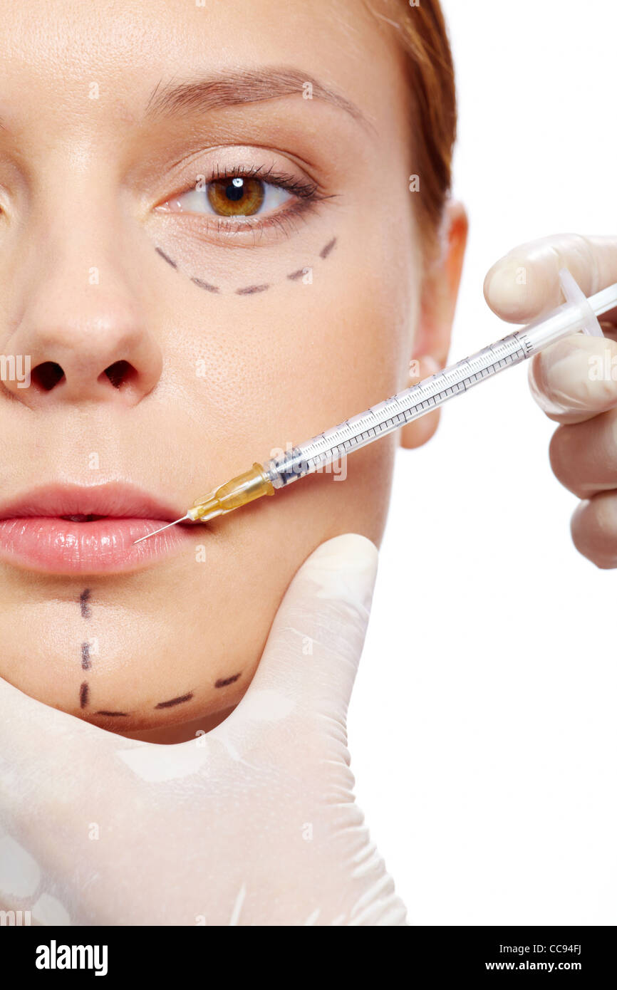 Fresh woman with marks drawn on face during botox procedure Stock Photo