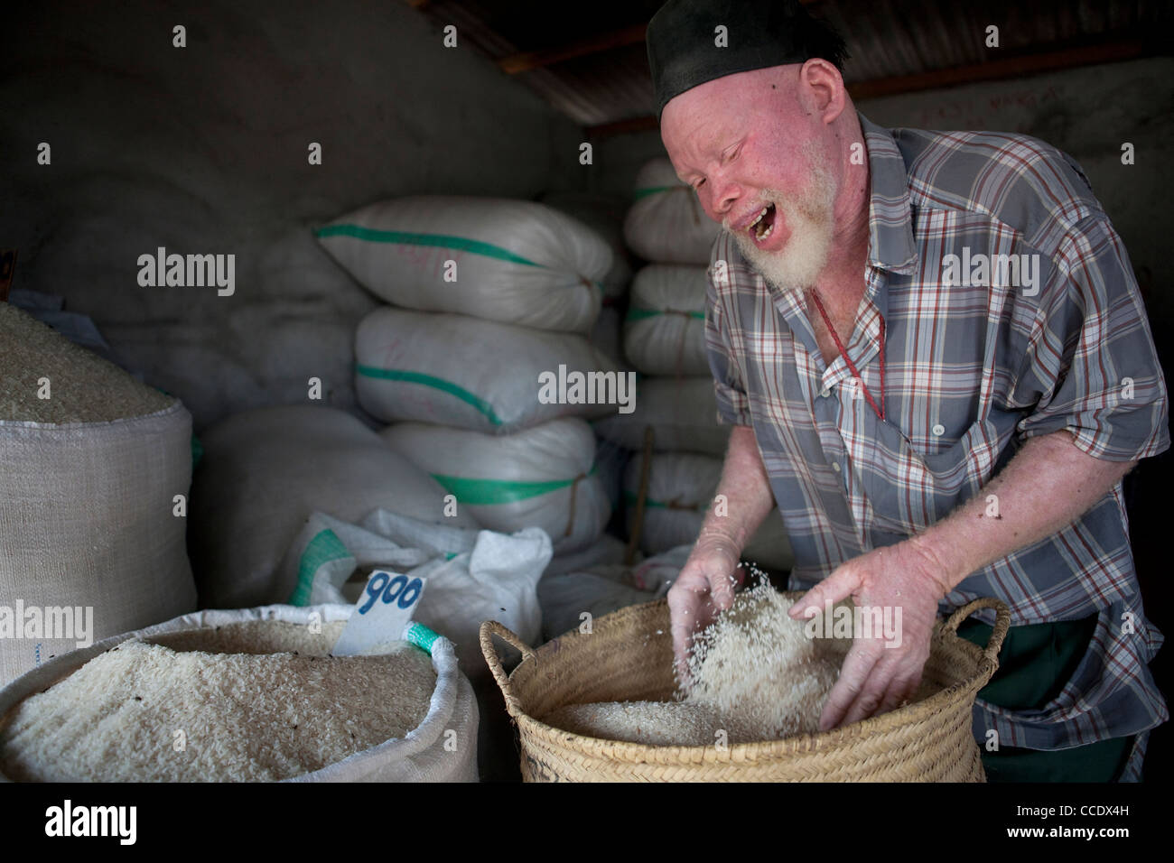 Albino human hi-res stock photography and images - Alamy