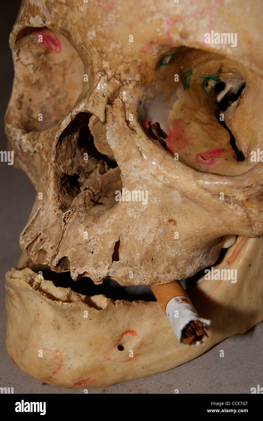 Smoking Kills.Best Awareness against smoking. Stock Photo