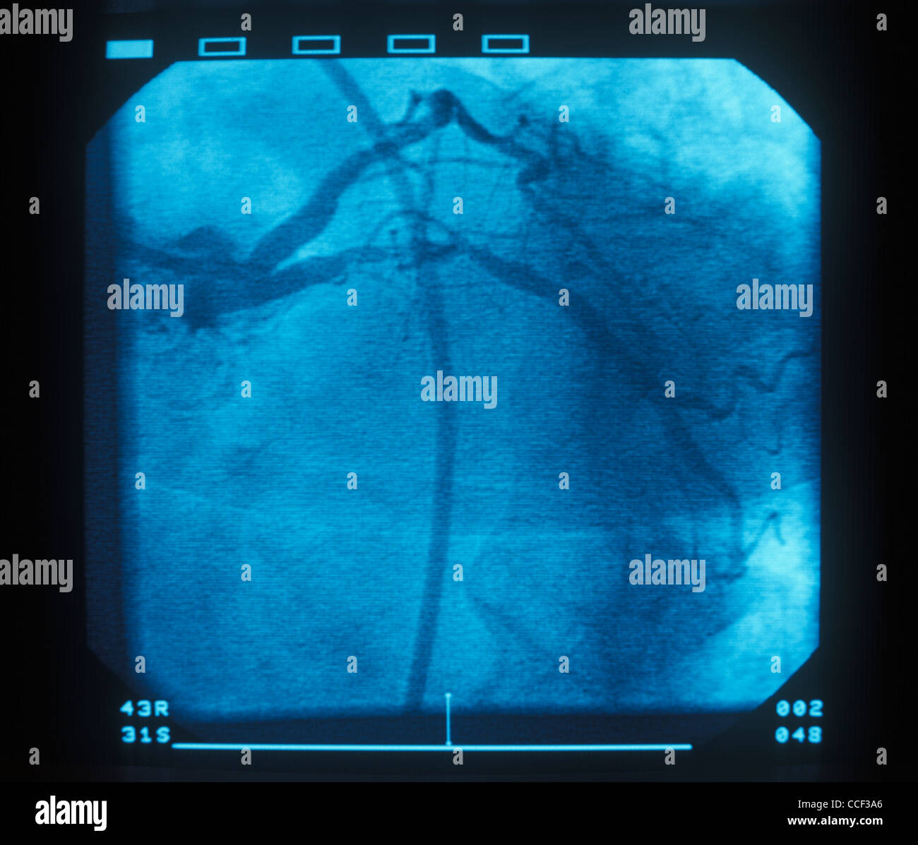 A close up of a cardiac x Ray exam. Stock Photo