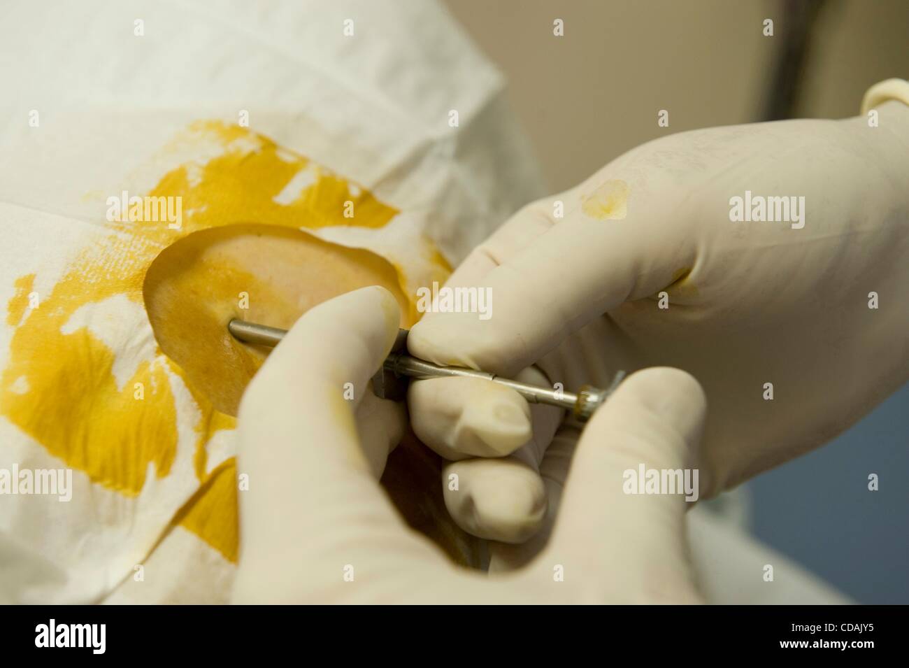 Testosterone replacement therapy hires stock photography and images