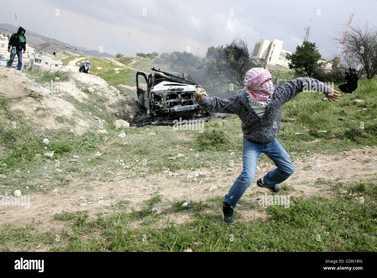 Burnt injuries hi-res stock photography and images - Alamy