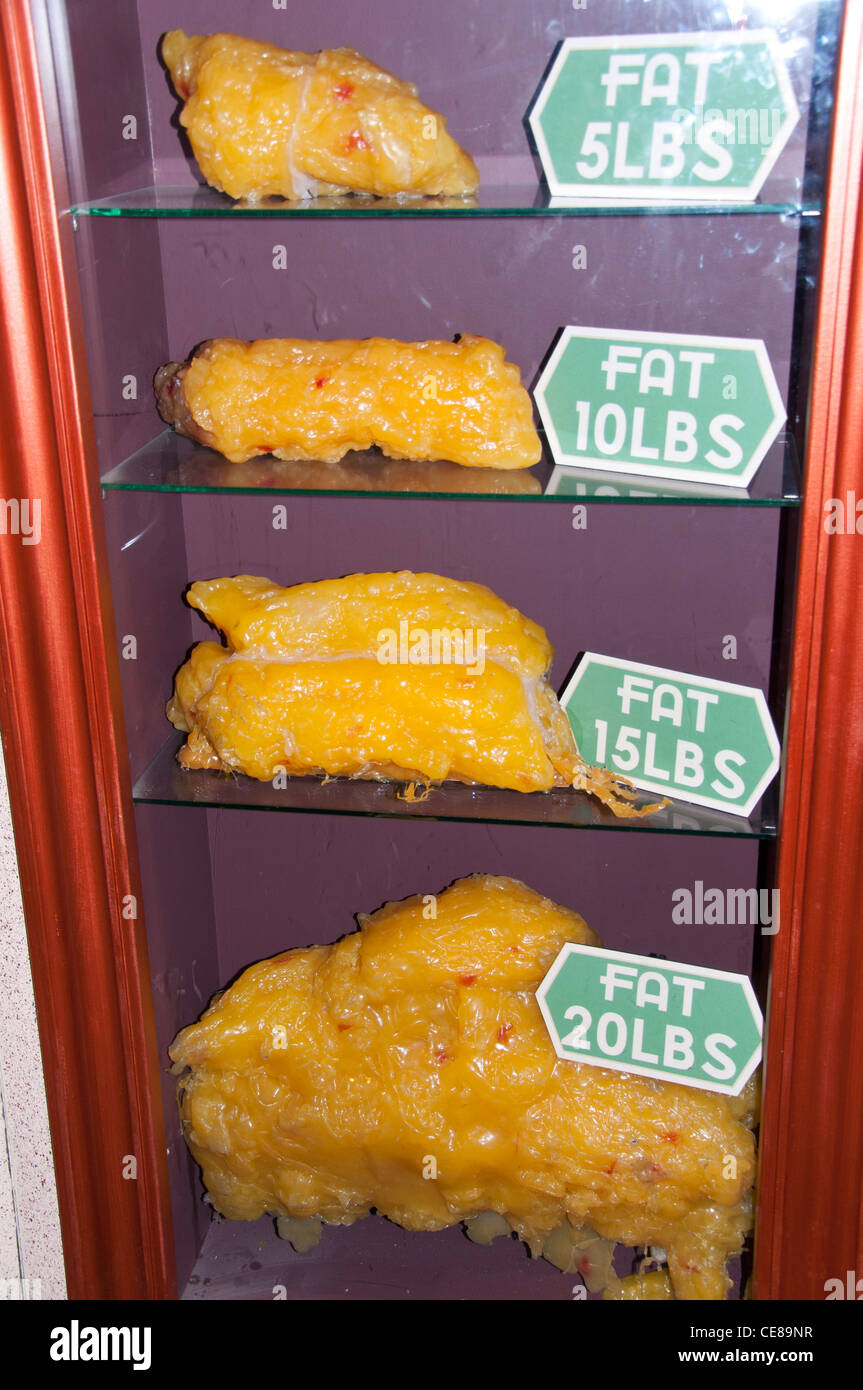 Body Fat Comparison Stock Photo - Alamy