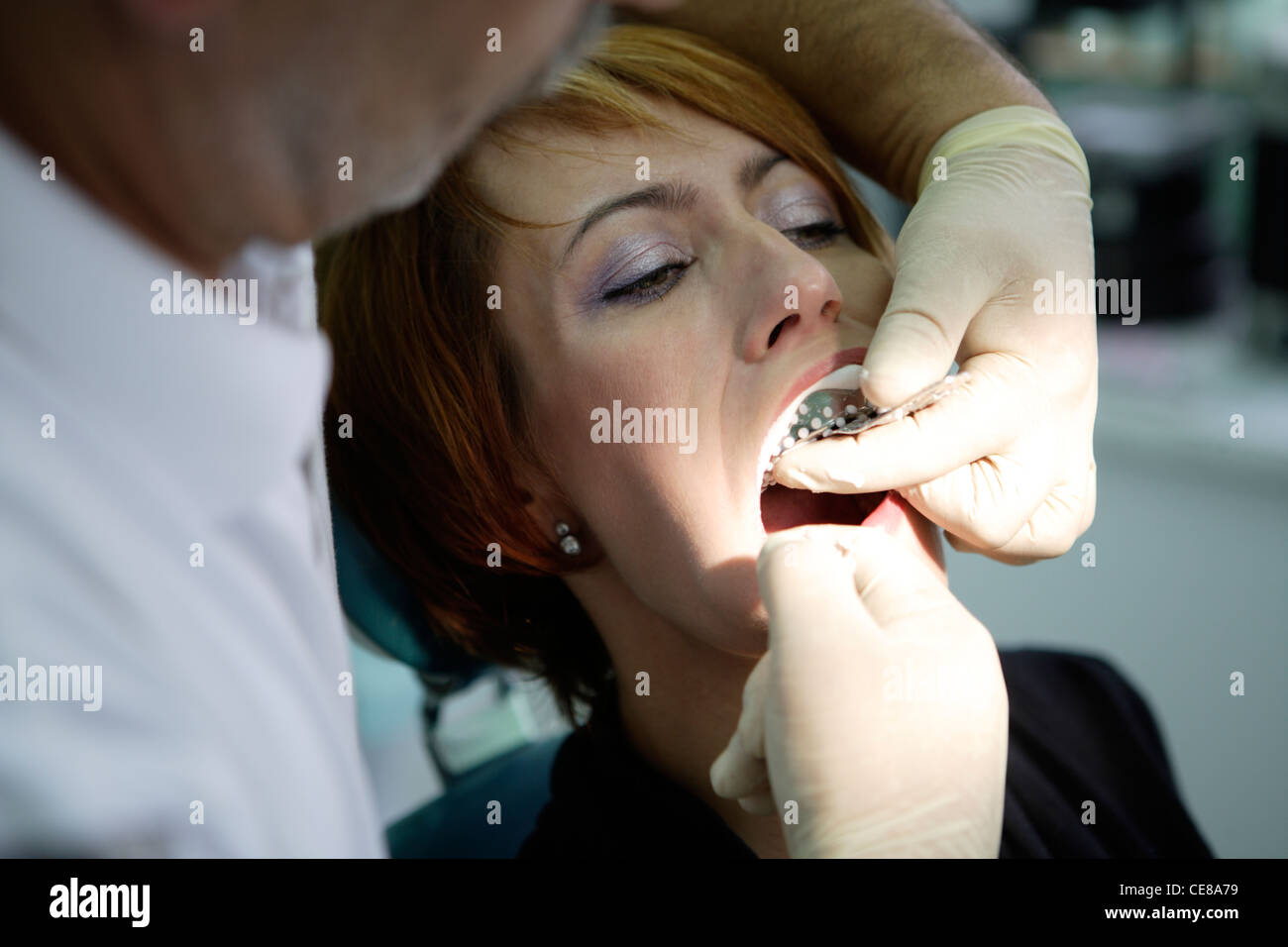 Woman, 39 years, dental examination, dental surgery, teeth impression for braces Stock Photo