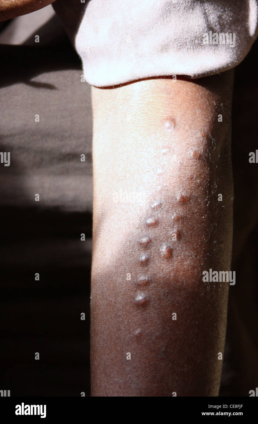 Scars on the back of a Chambri man to look like crocodile skin, Kanganaman  village, Middle Sepik, Papua New Guinea Stock Photo - Alamy